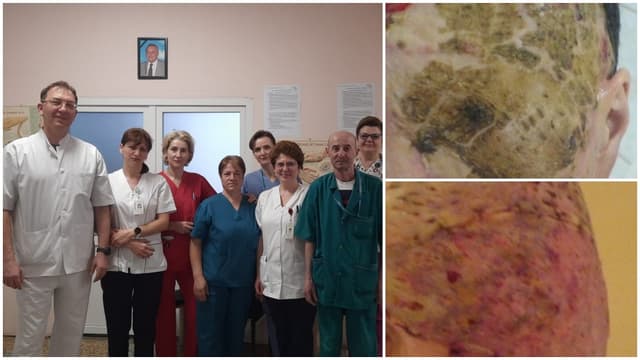 Pacientă cu afecțiuni complexe operată cu succes de echipa multidisciplinară a SJU Bacău, coordonată de dr. Iulian Ghimiș